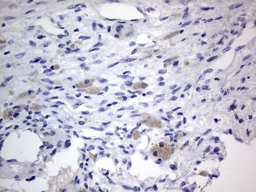 IGSF11 Antibody in Immunohistochemistry (Paraffin) (IHC (P))