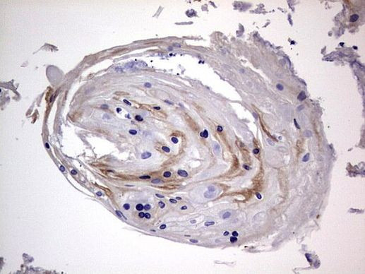 IGSF11 Antibody in Immunohistochemistry (Paraffin) (IHC (P))