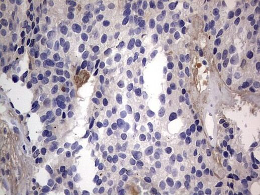 IGSF11 Antibody in Immunohistochemistry (Paraffin) (IHC (P))