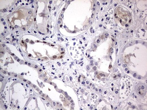 IGSF11 Antibody in Immunohistochemistry (Paraffin) (IHC (P))