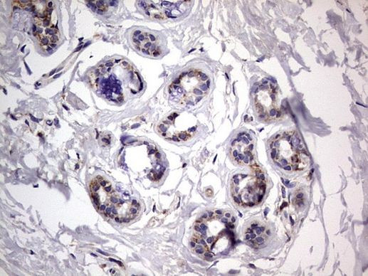 IGSF11 Antibody in Immunohistochemistry (Paraffin) (IHC (P))