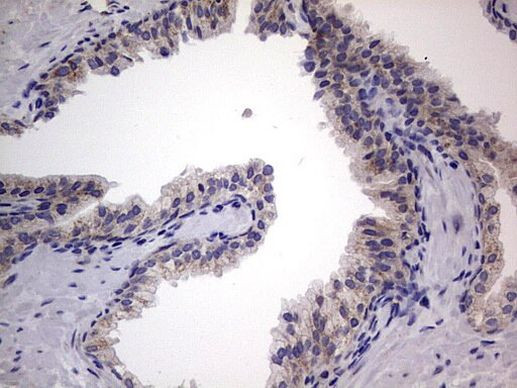 IGSF11 Antibody in Immunohistochemistry (Paraffin) (IHC (P))