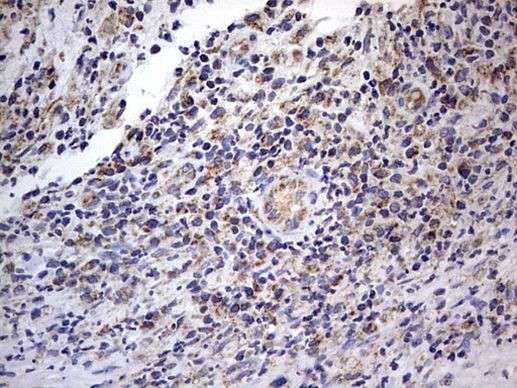 IGSF11 Antibody in Immunohistochemistry (Paraffin) (IHC (P))