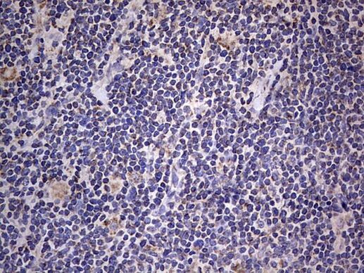 IGSF11 Antibody in Immunohistochemistry (Paraffin) (IHC (P))