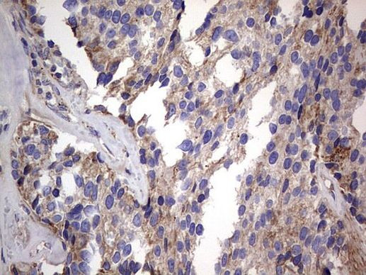 IGSF11 Antibody in Immunohistochemistry (Paraffin) (IHC (P))