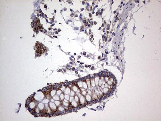 IGSF11 Antibody in Immunohistochemistry (Paraffin) (IHC (P))