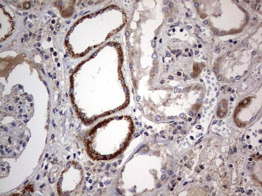 IGSF11 Antibody in Immunohistochemistry (Paraffin) (IHC (P))