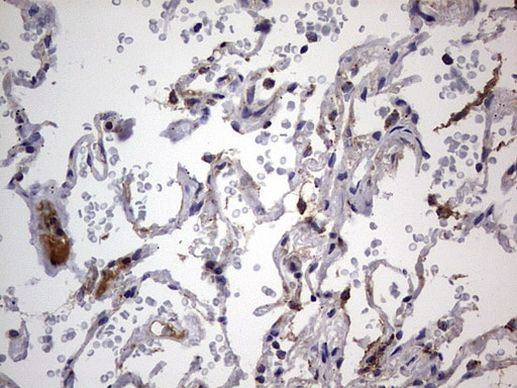 IGSF11 Antibody in Immunohistochemistry (Paraffin) (IHC (P))