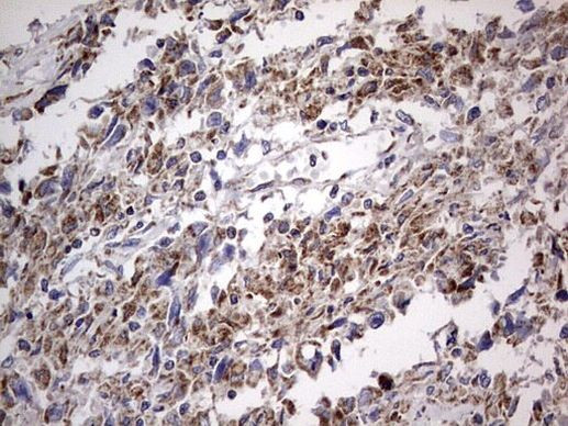 IGSF11 Antibody in Immunohistochemistry (Paraffin) (IHC (P))