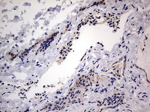 IGSF11 Antibody in Immunohistochemistry (Paraffin) (IHC (P))