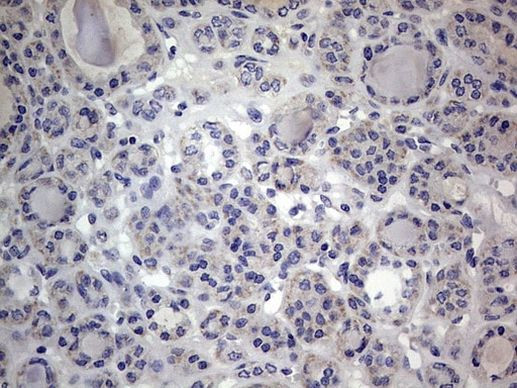 IGSF11 Antibody in Immunohistochemistry (Paraffin) (IHC (P))