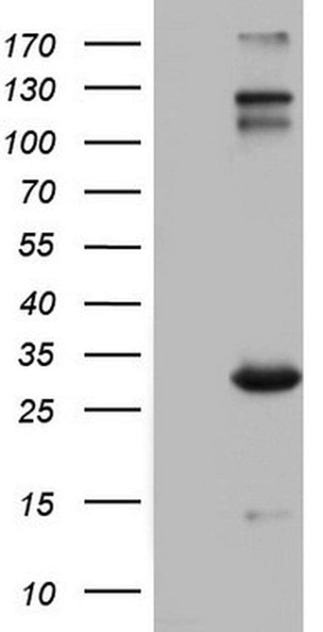 IGSF11 Antibody in Western Blot (WB)