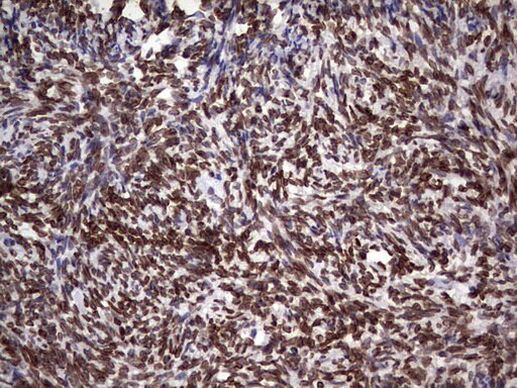 CK1 epsilon Antibody in Immunohistochemistry (Paraffin) (IHC (P))