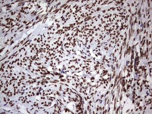 CK1 epsilon Antibody in Immunohistochemistry (Paraffin) (IHC (P))