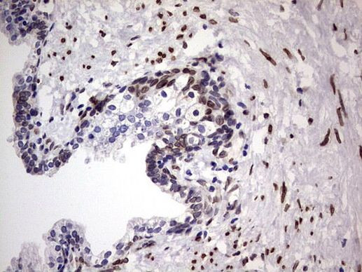 CK1 epsilon Antibody in Immunohistochemistry (Paraffin) (IHC (P))