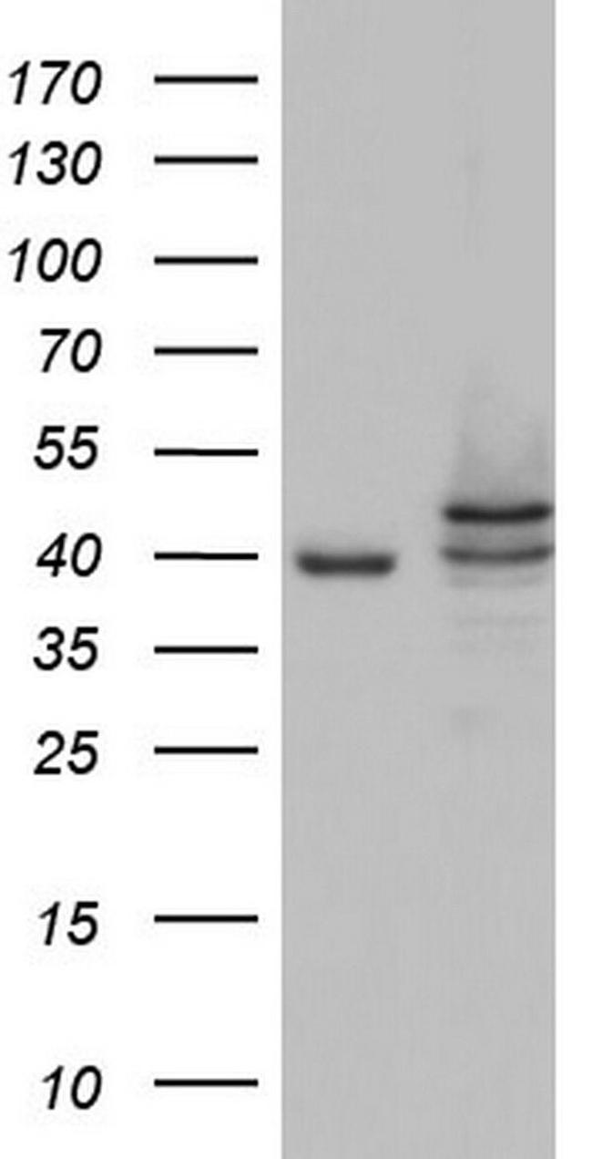 CK1 epsilon Antibody in Western Blot (WB)