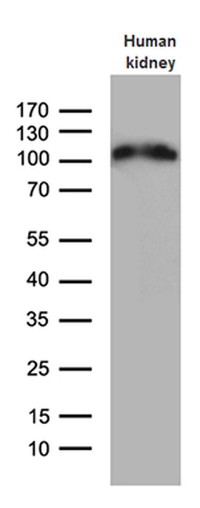 ACE2 Antibody in Western Blot (WB)