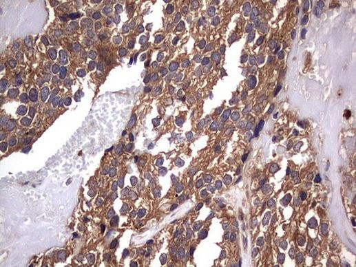 NRBF2 Antibody in Immunohistochemistry (Paraffin) (IHC (P))