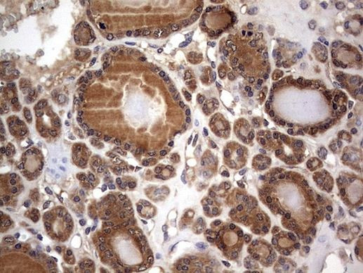 NRBF2 Antibody in Immunohistochemistry (Paraffin) (IHC (P))