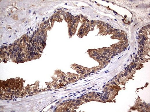 NRBF2 Antibody in Immunohistochemistry (Paraffin) (IHC (P))