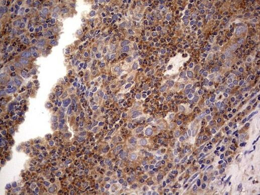 NRBF2 Antibody in Immunohistochemistry (Paraffin) (IHC (P))