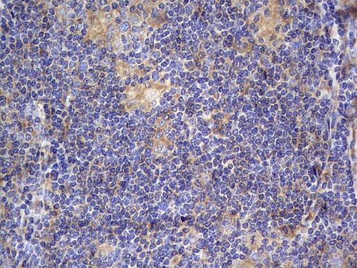 NRBF2 Antibody in Immunohistochemistry (Paraffin) (IHC (P))