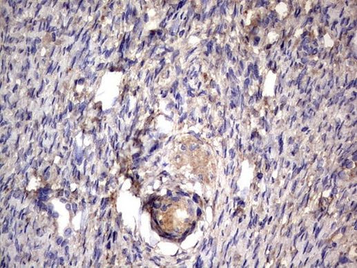 NRBF2 Antibody in Immunohistochemistry (Paraffin) (IHC (P))