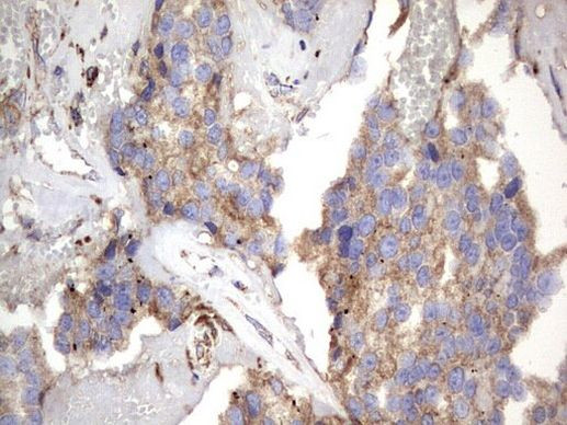 NRBF2 Antibody in Immunohistochemistry (Paraffin) (IHC (P))