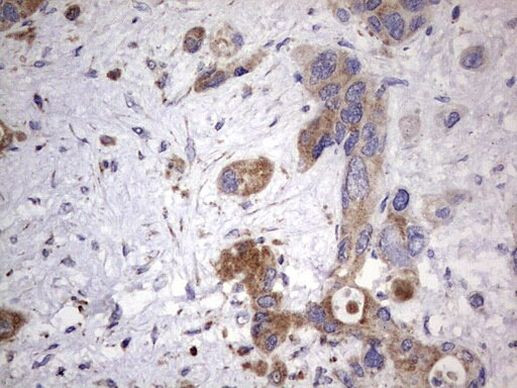 NRBF2 Antibody in Immunohistochemistry (Paraffin) (IHC (P))