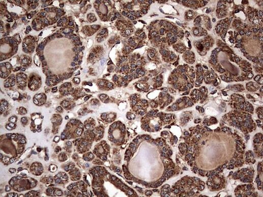 NRBF2 Antibody in Immunohistochemistry (Paraffin) (IHC (P))