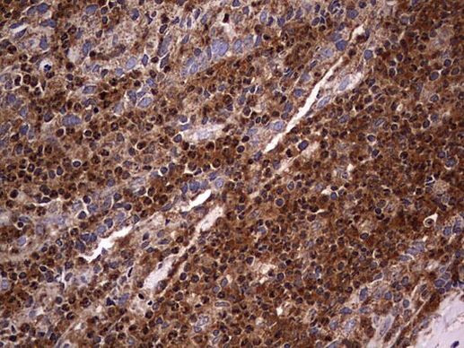 NRBF2 Antibody in Immunohistochemistry (Paraffin) (IHC (P))