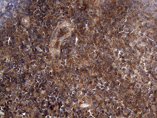 NRBF2 Antibody in Immunohistochemistry (Paraffin) (IHC (P))