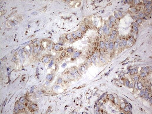 NRBF2 Antibody in Immunohistochemistry (Paraffin) (IHC (P))