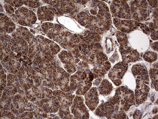 NRBF2 Antibody in Immunohistochemistry (Paraffin) (IHC (P))