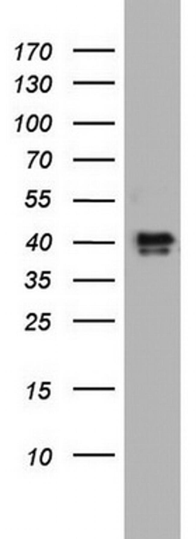 NRBF2 Antibody in Western Blot (WB)