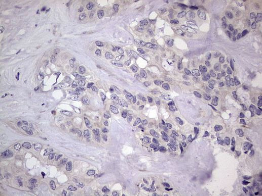 MURF3 Antibody in Immunohistochemistry (Paraffin) (IHC (P))