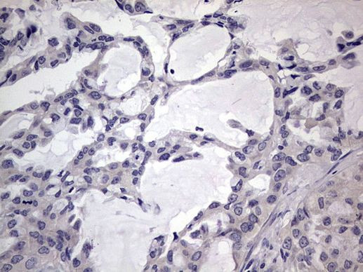 MURF3 Antibody in Immunohistochemistry (Paraffin) (IHC (P))