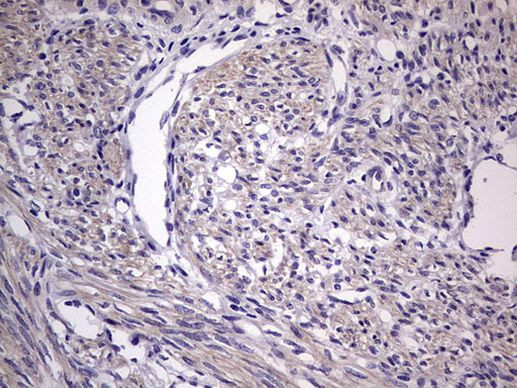 MURF3 Antibody in Immunohistochemistry (Paraffin) (IHC (P))