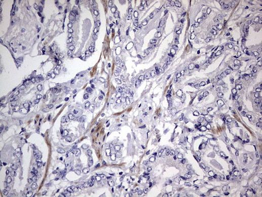 MURF3 Antibody in Immunohistochemistry (Paraffin) (IHC (P))