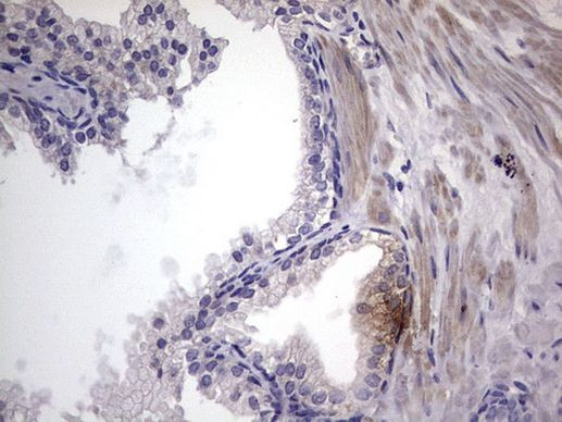 MURF3 Antibody in Immunohistochemistry (Paraffin) (IHC (P))