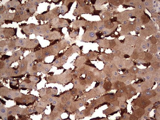 TRIM27 Antibody in Immunohistochemistry (Paraffin) (IHC (P))