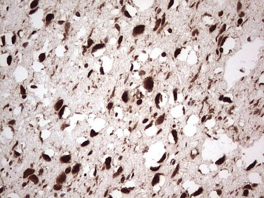 GLI1 Antibody in Immunohistochemistry (Paraffin) (IHC (P))