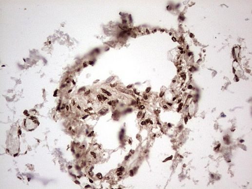 GLI1 Antibody in Immunohistochemistry (Paraffin) (IHC (P))