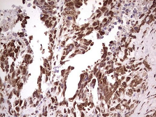 GLI1 Antibody in Immunohistochemistry (Paraffin) (IHC (P))