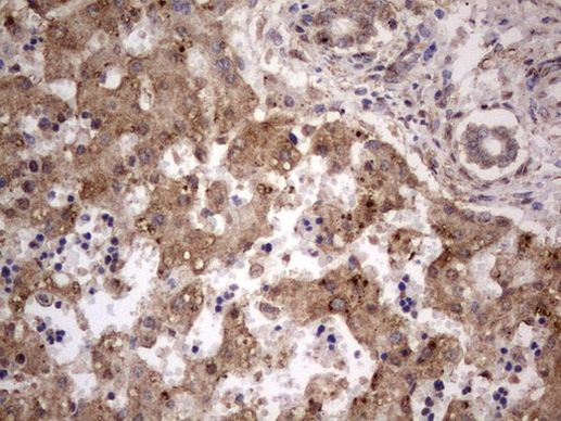 GLI1 Antibody in Immunohistochemistry (Paraffin) (IHC (P))