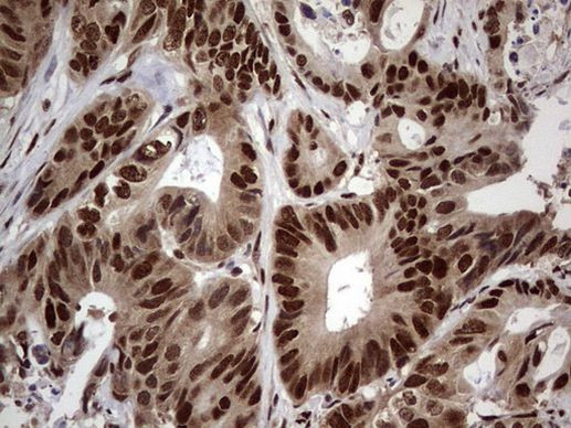 RTRAF Antibody in Immunohistochemistry (Paraffin) (IHC (P))