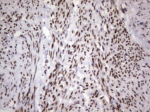 RTRAF Antibody in Immunohistochemistry (Paraffin) (IHC (P))