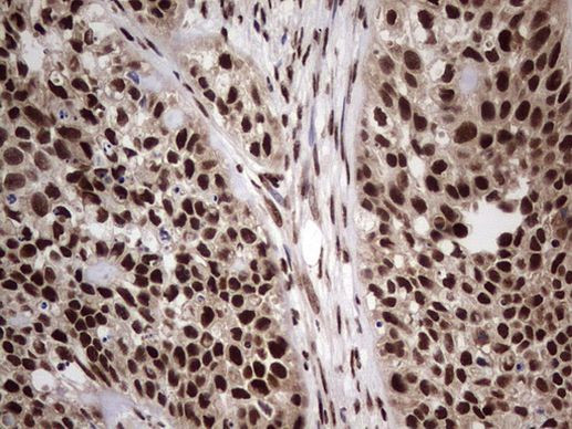 RTRAF Antibody in Immunohistochemistry (Paraffin) (IHC (P))