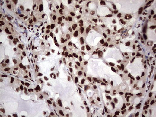 RTRAF Antibody in Immunohistochemistry (Paraffin) (IHC (P))