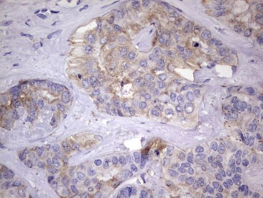 KYNU Antibody in Immunohistochemistry (Paraffin) (IHC (P))